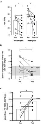 Theta-Burst Stimulation of Forearm Muscles in Patients With Complex Regional Pain Syndrome: Influence on Brain and Clinical Outcomes